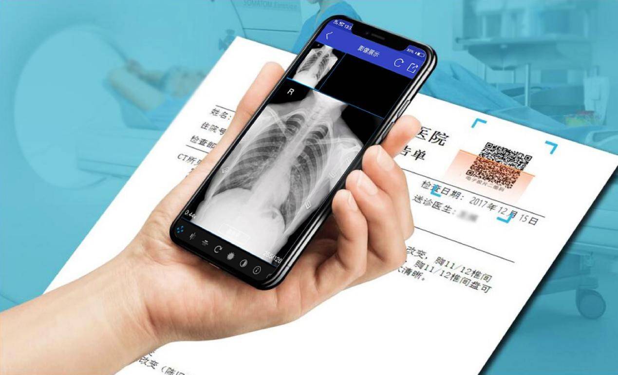 云膠片是什么？